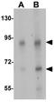 Transglutaminase 5 antibody, GTX31459, GeneTex, Western Blot image 