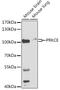 Protein Kinase C Epsilon antibody, GTX55749, GeneTex, Western Blot image 