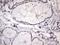 Kynureninase antibody, NBP2-45579, Novus Biologicals, Immunohistochemistry frozen image 