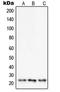 SUMO Peptidase Family Member, NEDD8 Specific antibody, LS-C353623, Lifespan Biosciences, Western Blot image 