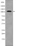 EPH Receptor A1 antibody, PA5-64783, Invitrogen Antibodies, Western Blot image 