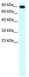 Apolipoprotein B MRNA Editing Enzyme Catalytic Subunit 3G antibody, TA329439, Origene, Western Blot image 