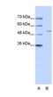 Zinc Finger Protein 555 antibody, NBP1-80166, Novus Biologicals, Western Blot image 