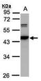 Calcium/Calmodulin Dependent Protein Kinase IV antibody, PA5-28346, Invitrogen Antibodies, Western Blot image 