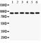 Toll Like Receptor 1 antibody, LS-C313521, Lifespan Biosciences, Western Blot image 