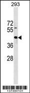 Zinc Finger Protein 331 antibody, 59-367, ProSci, Western Blot image 