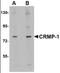 Collapsin Response Mediator Protein 1 antibody, orb88756, Biorbyt, Western Blot image 