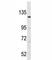 Large Tumor Suppressor Kinase 1 antibody, F50049-0.4ML, NSJ Bioreagents, Western Blot image 