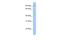 Tetratricopeptide Repeat Domain 16 antibody, A18061, Boster Biological Technology, Western Blot image 