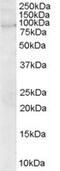 Rho Guanine Nucleotide Exchange Factor 4 antibody, MBS420576, MyBioSource, Western Blot image 