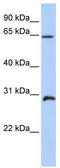 Homeobox A5 antibody, TA345267, Origene, Western Blot image 