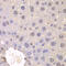 Fibroblast Growth Factor Receptor 1 antibody, STJ23657, St John
