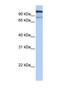 Glucosidase Alpha, Acid antibody, NBP1-69295, Novus Biologicals, Western Blot image 