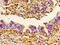 Proteinase 3 antibody, LS-C670721, Lifespan Biosciences, Immunohistochemistry paraffin image 