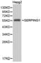 Serpin Family G Member 1 antibody, LS-C192710, Lifespan Biosciences, Western Blot image 