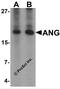 Angiogenin antibody, 6983, ProSci, Western Blot image 