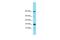 Chromosome 11 Open Reading Frame 87 antibody, A16814, Boster Biological Technology, Western Blot image 