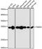 GP25L2 antibody, A3442, ABclonal Technology, Western Blot image 