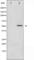 Histone Deacetylase 2 antibody, abx010896, Abbexa, Western Blot image 