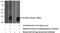 Interleukin 1 Receptor Antagonist antibody, 10844-1-AP, Proteintech Group, Western Blot image 