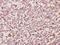 Proteasome 26S Subunit, Non-ATPase 2 antibody, A06642, Boster Biological Technology, Immunohistochemistry frozen image 