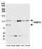Poly(ADP-Ribose) Polymerase Family Member 10 antibody, A300-665A, Bethyl Labs, Western Blot image 