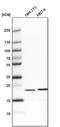 Transgelin 2 antibody, NBP1-89722, Novus Biologicals, Western Blot image 