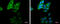 Matrix Metallopeptidase 13 antibody, GTX100665, GeneTex, Immunofluorescence image 