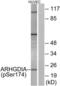 Rho GDP Dissociation Inhibitor Alpha antibody, LS-C198642, Lifespan Biosciences, Western Blot image 