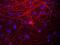 Neurofilament Medium antibody, NB300-222, Novus Biologicals, Immunocytochemistry image 