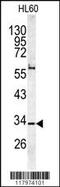 Capping Actin Protein Of Muscle Z-Line Subunit Alpha 1 antibody, MBS9213856, MyBioSource, Western Blot image 