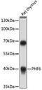 PHD Finger Protein 6 antibody, 18-308, ProSci, Western Blot image 