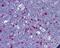 Nucleophosmin 1 antibody, 48-793, ProSci, Immunohistochemistry paraffin image 
