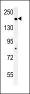 Adenylate cyclase type 10 antibody, LS-C156065, Lifespan Biosciences, Western Blot image 