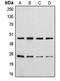 CD28 antibody, LS-C351965, Lifespan Biosciences, Western Blot image 