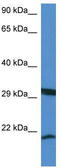 RHEB Like 1 antibody, TA340329, Origene, Western Blot image 