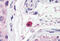 Tumor necrosis factor receptor superfamily member 13B antibody, MBS240310, MyBioSource, Immunohistochemistry frozen image 