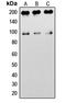Insulin Like Growth Factor 1 Receptor antibody, LS-C359027, Lifespan Biosciences, Western Blot image 