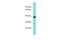 Inactive N-acetylated-alpha-linked acidic dipeptidase-like protein 2 antibody, A11421, Boster Biological Technology, Western Blot image 