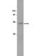 Myristoylated Alanine Rich Protein Kinase C Substrate antibody, NBP2-29726, Novus Biologicals, Western Blot image 