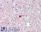 Phosphoglucomutase 2 Like 1 antibody, LS-B15243, Lifespan Biosciences, Immunohistochemistry paraffin image 