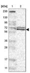 Replication Protein A1 antibody, NBP1-89658, Novus Biologicals, Western Blot image 