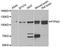 Protein Tyrosine Phosphatase Non-Receptor Type 3 antibody, A6400, ABclonal Technology, Western Blot image 