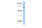 Testis Expressed Metallothionein Like Protein antibody, 30-905, ProSci, Enzyme Linked Immunosorbent Assay image 