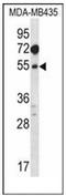 S-adenosylmethionine synthase isoform type-1 antibody, AP52613PU-N, Origene, Western Blot image 