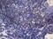 Sorting Nexin 10 antibody, M07395, Boster Biological Technology, Immunohistochemistry paraffin image 