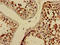 ELMO Domain Containing 2 antibody, LS-C677810, Lifespan Biosciences, Immunohistochemistry paraffin image 