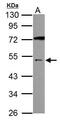 Gamma-Aminobutyric Acid Type A Receptor Alpha5 Subunit antibody, PA5-31163, Invitrogen Antibodies, Western Blot image 