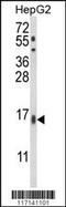 Microsomal Glutathione S-Transferase 2 antibody, 63-683, ProSci, Western Blot image 