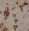 Protein Tyrosine Phosphatase Non-Receptor Type 18 antibody, FNab06934, FineTest, Immunohistochemistry paraffin image 